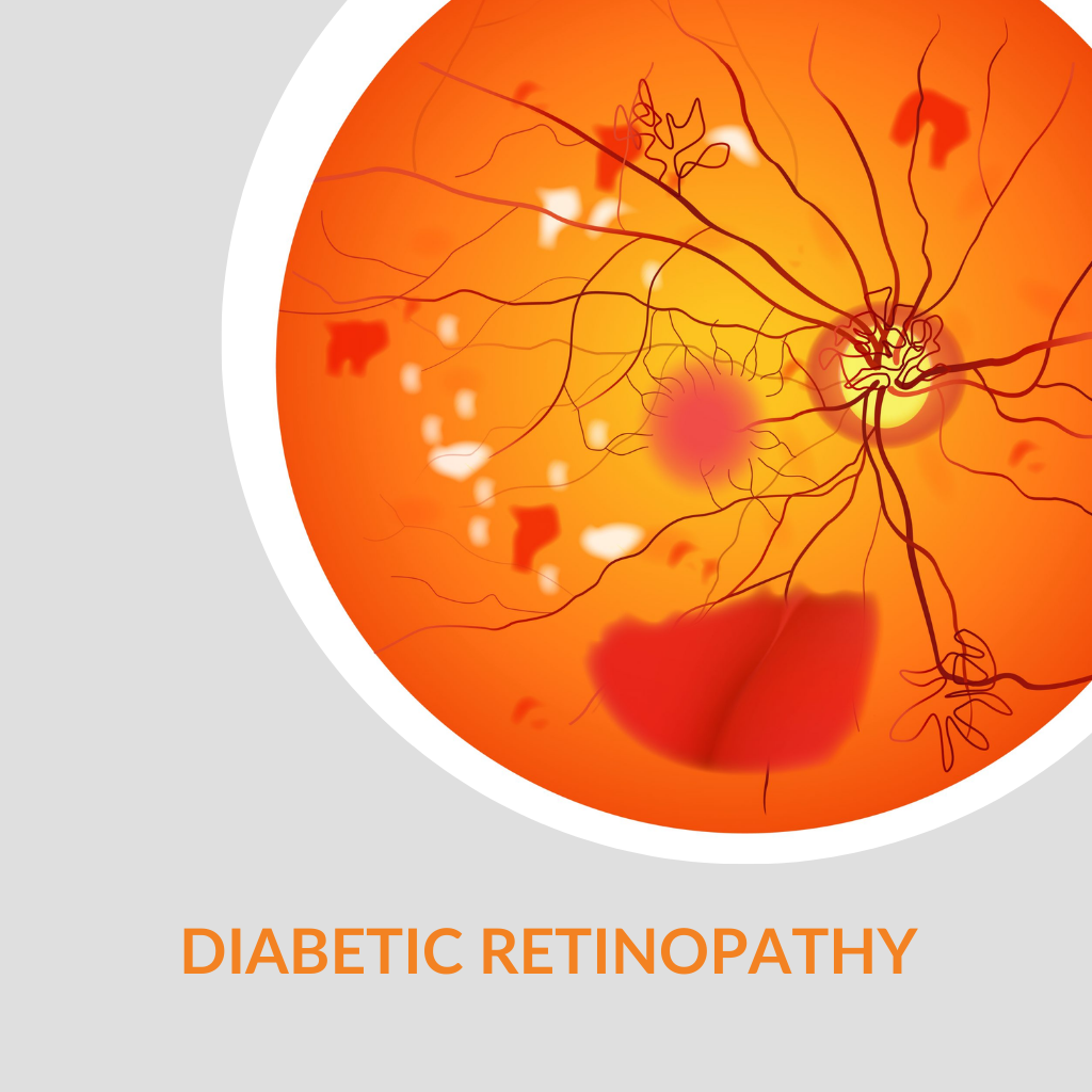 diabetic-retinopathy-disease