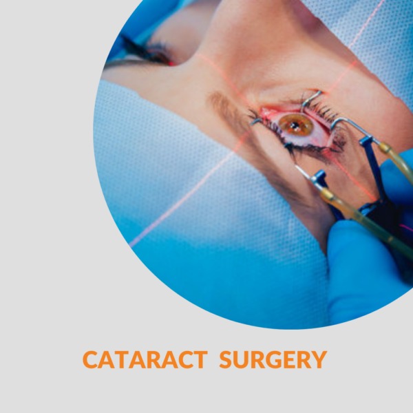 cataract