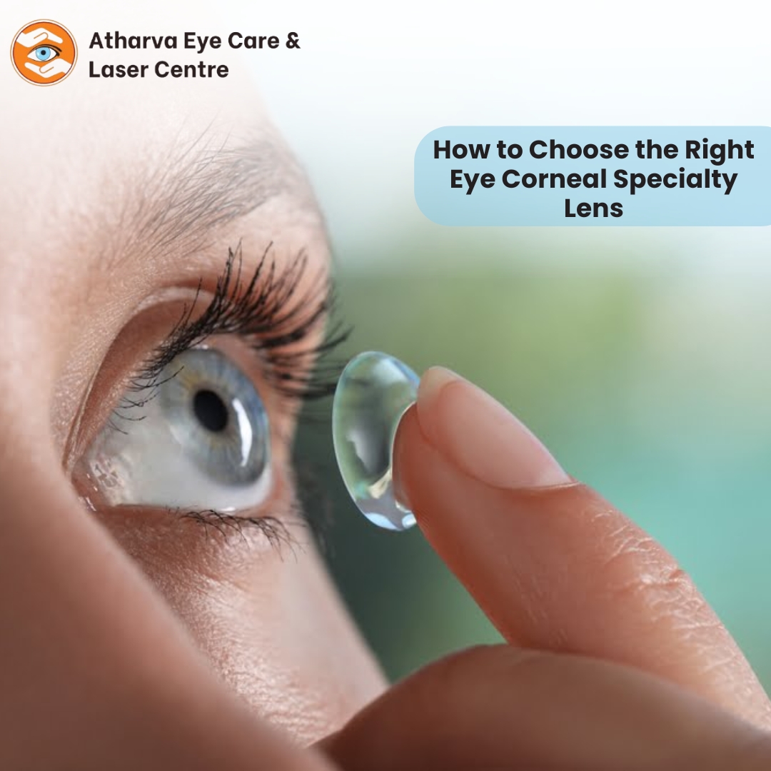 Choose the Right Eye Corneal Specialty Lens